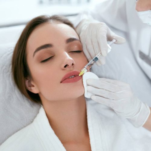 Dermal Lip Filler 1